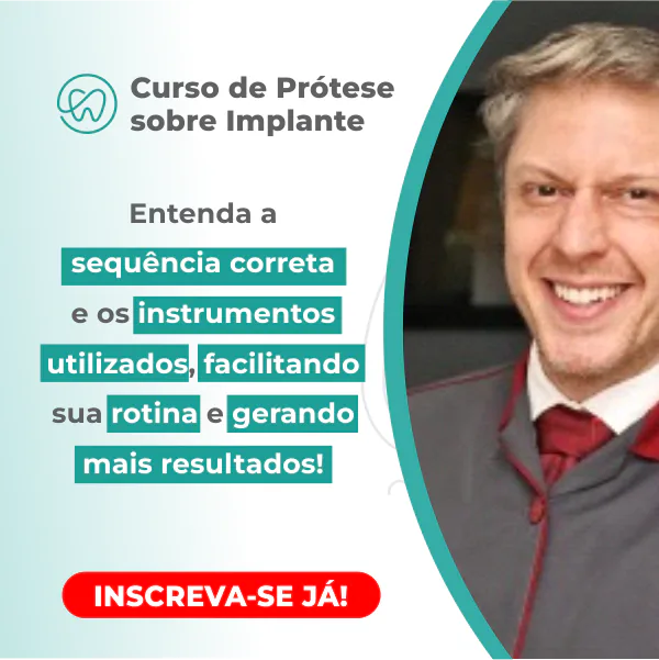 Curso Prótese sobre Implante